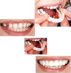 [2490] Snap On Comfortable Fit Flex Cosmetic Teeth Top Veneer Smile Denture Cover