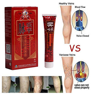 [2571] 30g Varicose Veins Treatment Leg Acid Bilges Itching Lumps Vasculitis